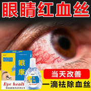 眼睛红血丝修复去除干涩去黄缓解眼睛疲劳干涩神器消眼睛红血丝