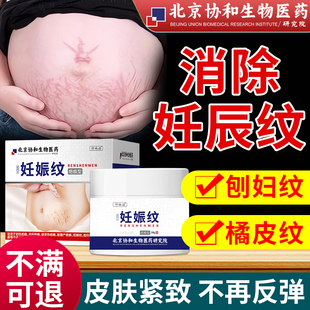 妊娠纹产后消除修复霜孕妇紧致肚皮淡化妊娠纹去除疤痕膏BM