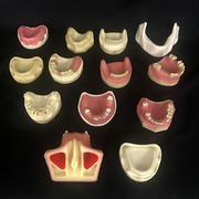 牙科材料种植模型教学练习考试牙齿牙模牙科备牙正畸病理口腔模型