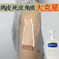 果酸身体乳去鸡皮肤疙瘩，毛囊角化角质鱼鳞霜病干燥起皮去除神器