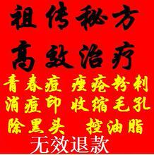 孟公祖传消痘液,中药快速根治痘痘粉刺青春痘痤疮控油脂祛痘印！