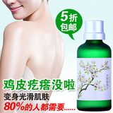 正品 卿颜阁毛周角化去角质精华液 去鸡皮肤/鸡皮疙瘩角化症