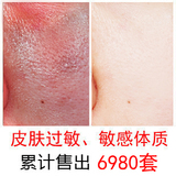 中药脱敏抗敏感性肌肤青黛敏安修护霜过敏皮肤修复荨麻疹舒缓特效