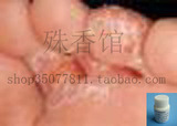 超级买家秀脚气脚癣脚起泡脚起皮香港脚烂脚丫足癣