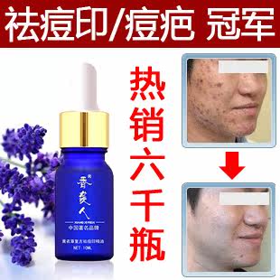 ��Ʒ ��Ϯ�� ����:amp:lt;span class=H:amp:gt;�:amp:lt;/span:amp:gt;ӡ��:amp:lt;span class=H:amp:gt;��:amp:lt;/span:amp:gt;���� 10ml ȥ��ӡ��:amp:lt;span class=H:amp:gt;��:amp:lt;/span:amp:gt;��������