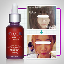 Mo amour 正品 包邮 强效瘦下巴瘦脸颊提升紧致脂肪型瘦脸精油
