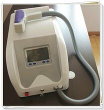 【全国热销】激光洗眉机/纹身清洗机/激光洗纹机/激光洗纹身仪器