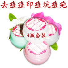 包邮送大礼全网最低果酸换肤面霜10%+18%+25%+35%祛痘印坑疤凹洞