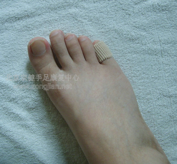 包郵男女纖維矽膠趾套老繭分趾防磨腳保護套 高跟鞋擠腳在類目 個人護理/保健/按摩器材, 家用保健器材, 保健護具(護腰/膝/腿)中 - 來自Buy2taobao.com提供專業的淘寶代購服務