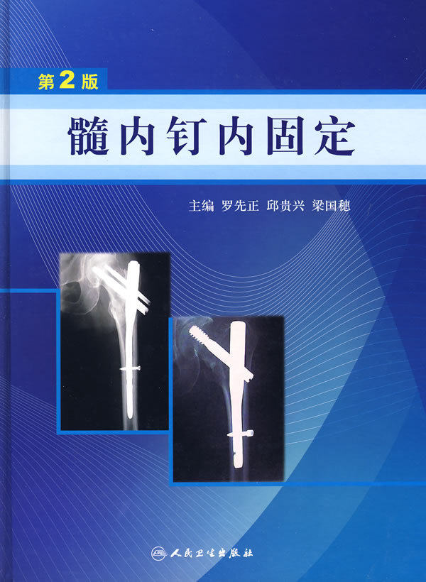 【现货】髓内钉内固定-(第2版) 人民卫生出版社 罗先生