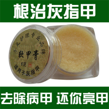 Onychomycosis-specific cure for soft-paste the treatment of onychomycosis onychomycosis cure toenail onychomycosis drug
