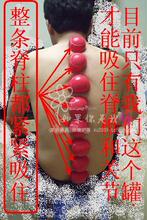 买就送!  易罐 硅胶罐 硅橡胶拔罐器 变形除湿器 聚力 康祝