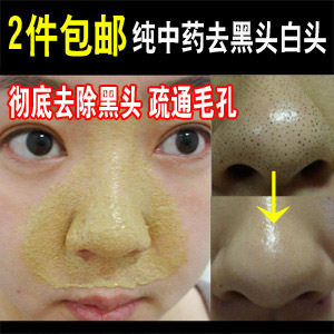 好用到流泪！纯中药去黑头面膜 黑头面膜粉 黑头白头 黑头导出