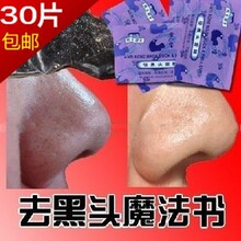 ��30Ƭ���� ѩ������ͷ��Ĥ˺��ȥ��ͷ����Ĥ ����ҩ��ë��1Ƭ
