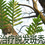 淘宝精品商城<em>斑秃</em>古方治疗<em>女性</em>男士<em>斑秃</em>顶脂溢