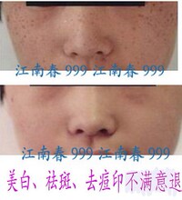 100%好评美白凝葆丽柔润雪颜美白保湿组合护肤淡斑去皱亮泽嫩滑
