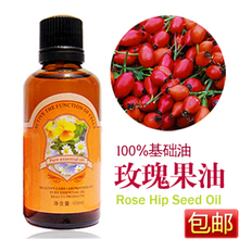 包邮！YAERDUN/雅而顿 玫瑰果油100ML 正品美白保湿去疤去痘印！