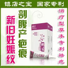 �Ƽ���ȥ����������/�ʸ����̺�/������ �������޸�˪ �����ڿ���