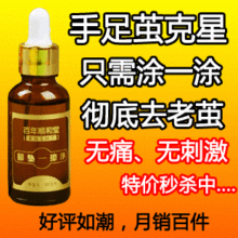 顺和堂专业去除老茧厚皮袪脚茧脚垫手茧胼胝茧子角质老茧净去死皮