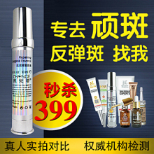 中药祛斑美白 去斑淡斑消斑去痘印 专去遗传性雀斑黄褐斑反弹斑