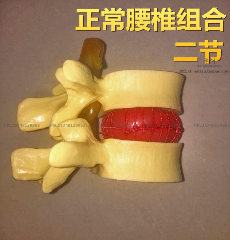 116正品醫學腰椎正常組合模型椎間盤突出骨科教學骨骼模型二節在類目 玩具/童車/益智/積木/模型, 靜態模型, 其他模型玩具中 - 來自Buy2taobao.com提供專業的淘寶代購服務