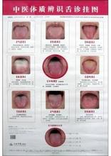 【舌诊挂图】最新最全舌诊挂图 产品参考信息