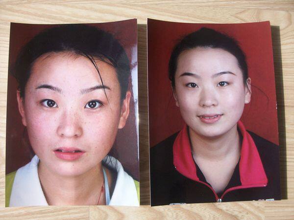 佰草世家美白祛斑精油男<em>女士去</em>遗传<em>雀斑</em>黄褐斑