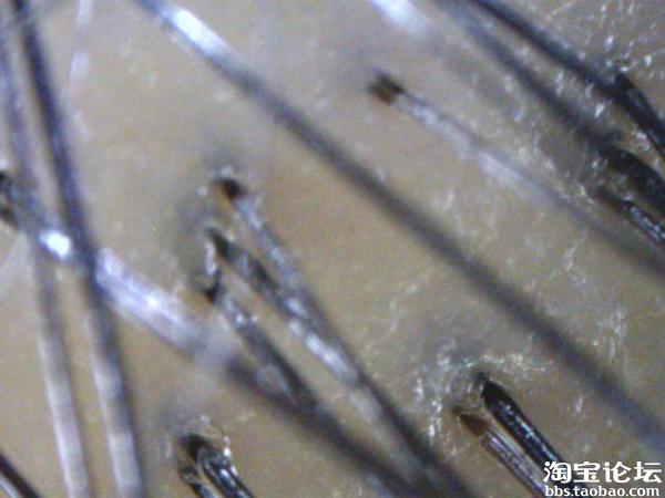 [国际研究]逆转<em>头发</em>微型化-超级养发液 TR1 - 超