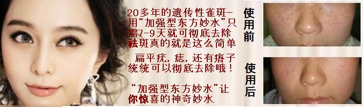 快速祛斑、遗传性雀斑、扁平疣加强型东方妙水