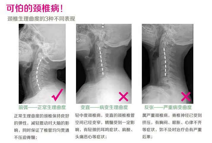 颈椎病到底什么原因造成的?颈椎病能治好吗?