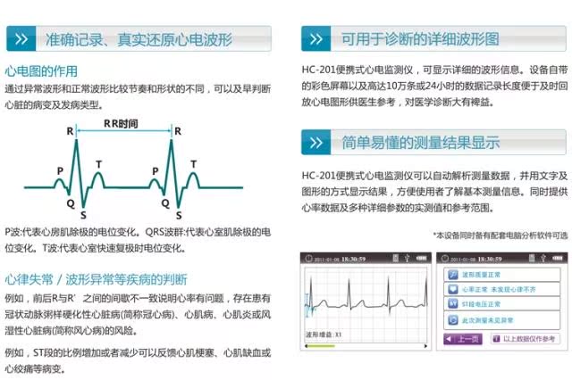 家用便携式心电图机 心电监测仪监护仪 Holter Hc 201标准版 仪器交易网 2914