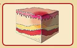 伤口不愈合_伤口化脓_伤口感染_伤口愈合慢_