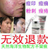 贝泉BEAQAR海洋生物祛痘产品 青春痘 粉刺 痘痘 痤疮 祛痘印痘疤