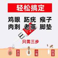 【脚医生】鸡眼膏贴去鸡眼跖疣券后9元包邮